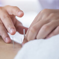 Acupuncture